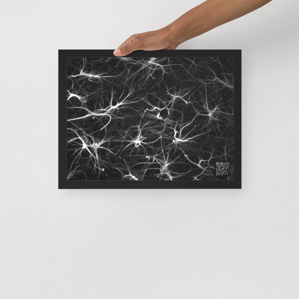 Tableau - Les cellules qui protège nos neurons